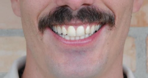 barba-20 barba-20