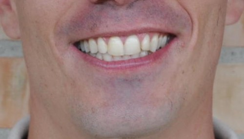 barba-21 barba-21